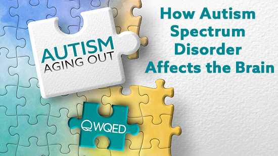 How Autism Spectrum Disorder Affects the Brain